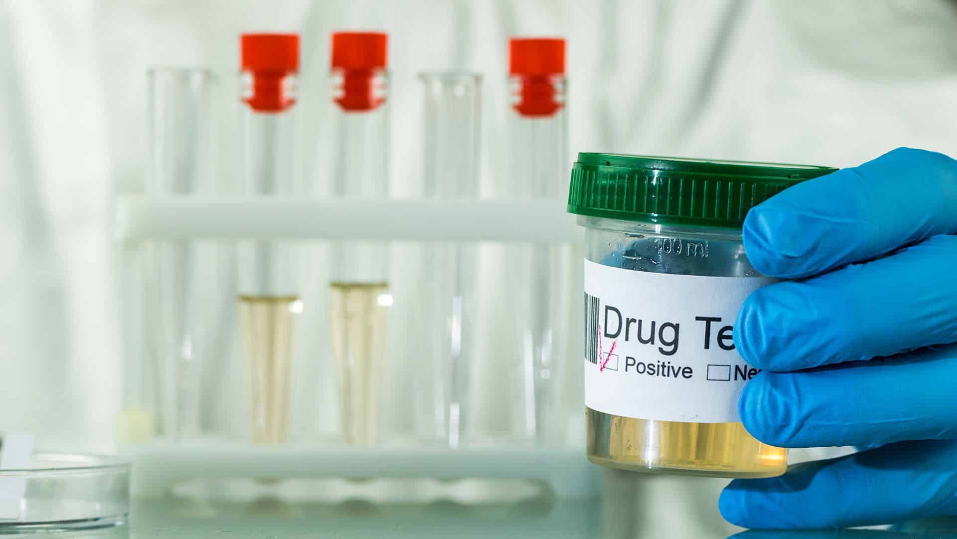 drug testing and mandatory treatment